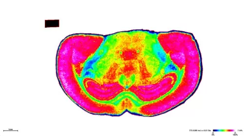 Heatmaps of spatial variation in metabolite levels Heatmaps of spatial variation in metabolite levels